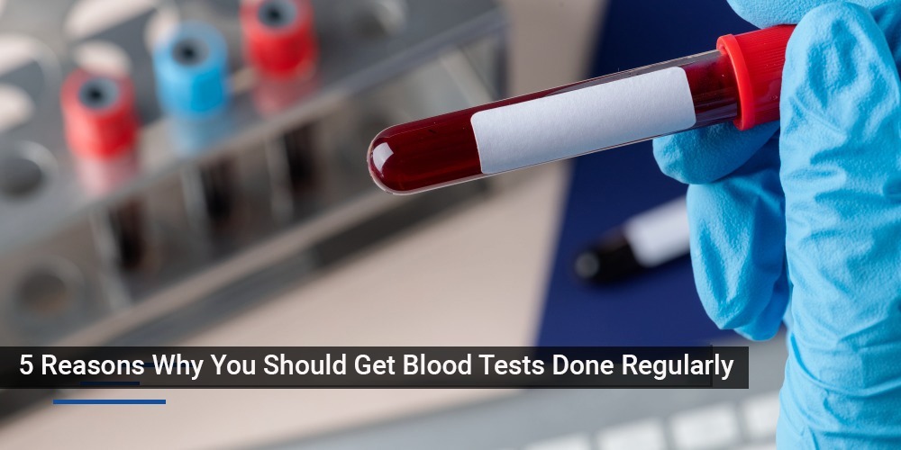 5 reasons why you should get blood tests regularly